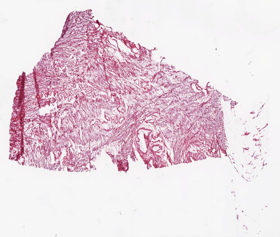 Slide Thumbnail