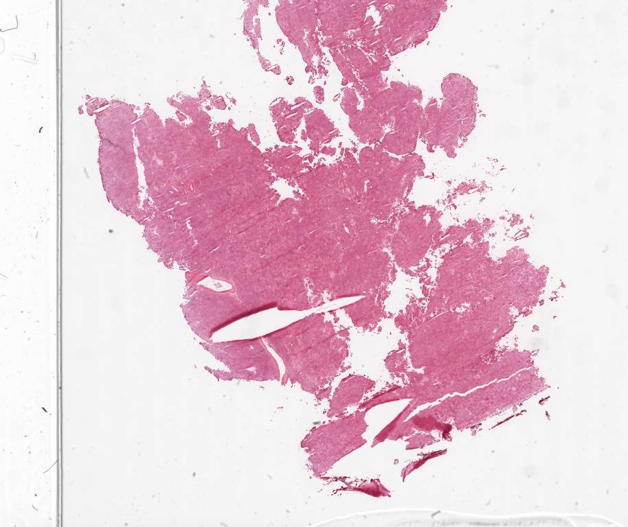 Slide Thumbnail