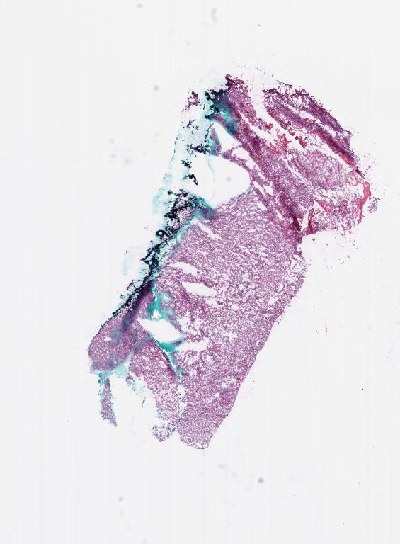 Slide Thumbnail