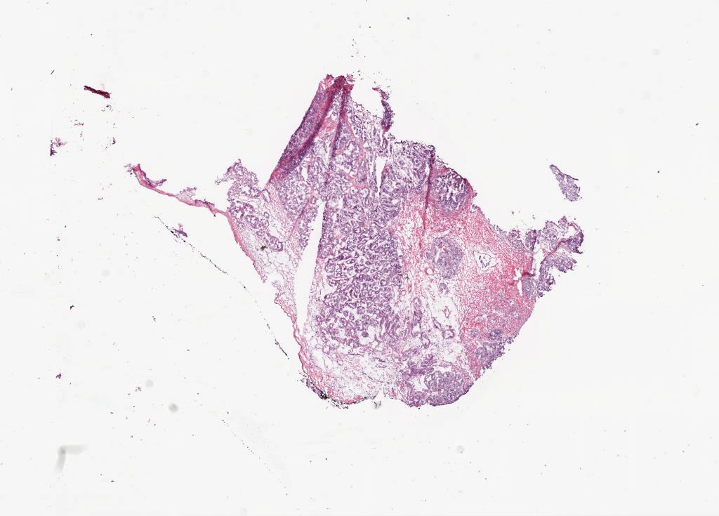 Slide Thumbnail