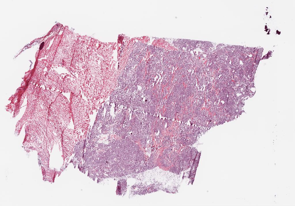 Slide Thumbnail