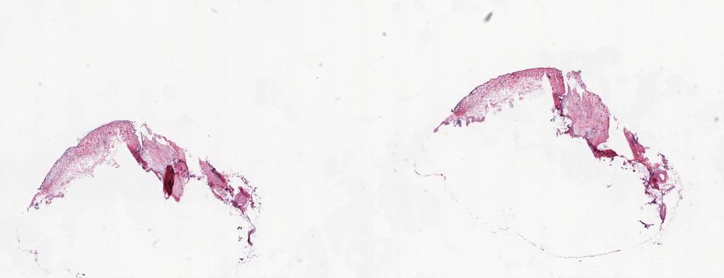 Slide Thumbnail