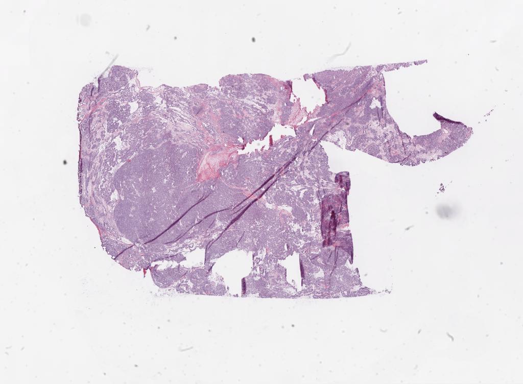 Slide Thumbnail