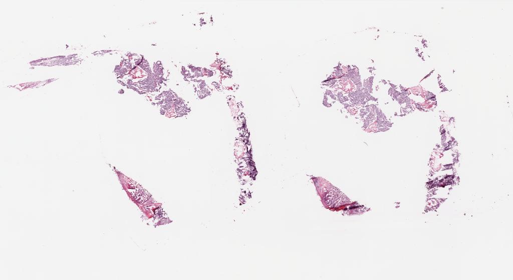 Slide Thumbnail