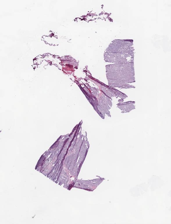 Slide Thumbnail