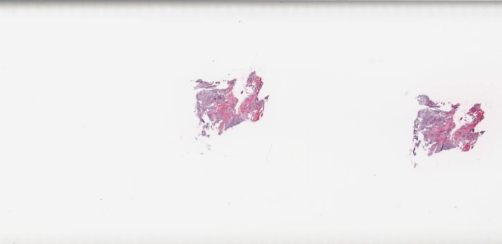 Slide Thumbnail