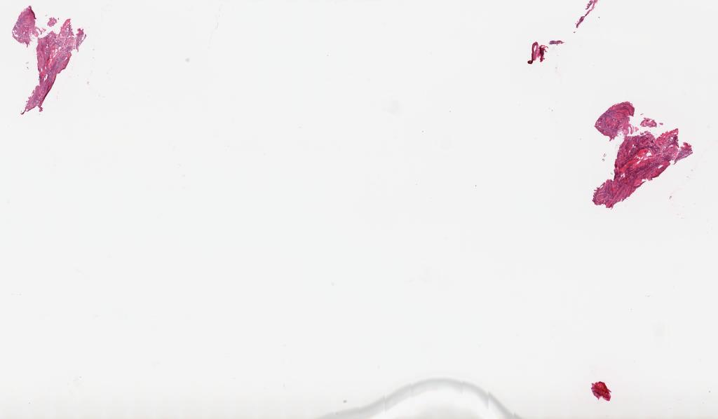 Slide Thumbnail